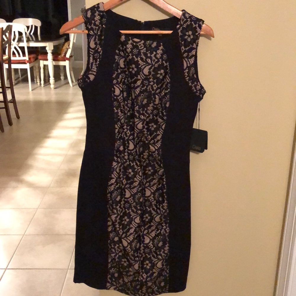 Black & bone lace dress